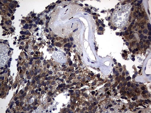 DDIT3 / CHOP Antibody (clone OTI2D3)