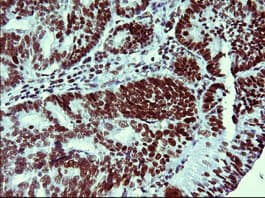 TP73 / p73 Antibody (clone OTI2H5)