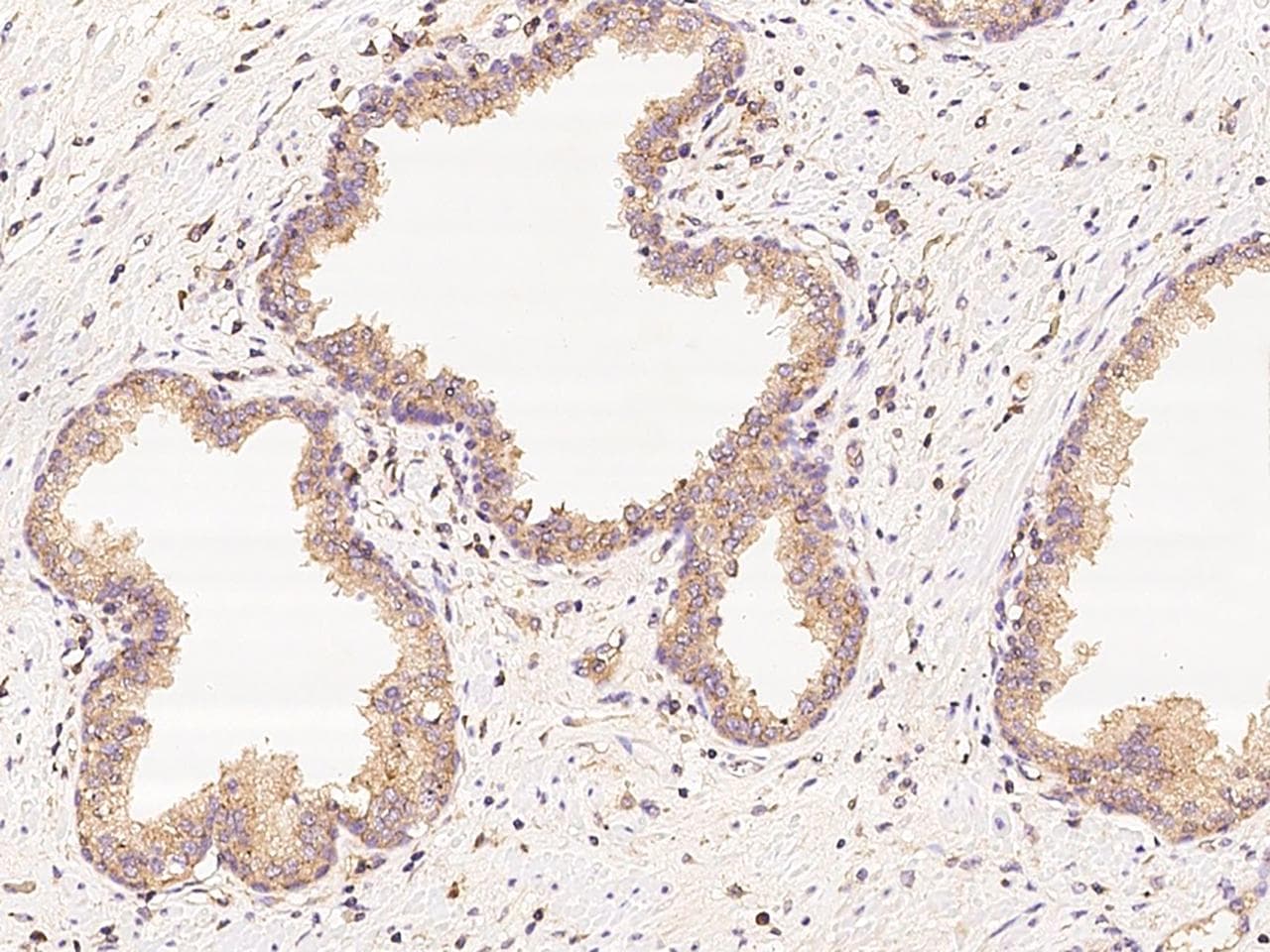 GAK Antibody