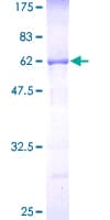 Human CNOT7 Protein (Recombinant GST)