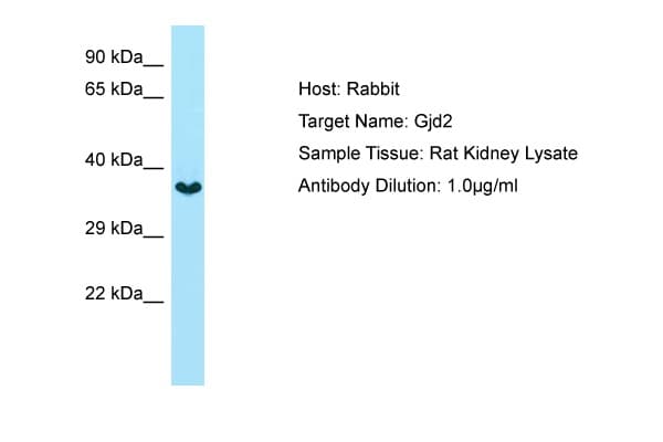 GJD2 / CX36 / Connexin 36 Antibody (aa131-180)