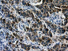 Monoclonal Mouse anti-Human MAC-2-BP / LGALS3BP Antibody (clone OTI6B7, IHC, WB)