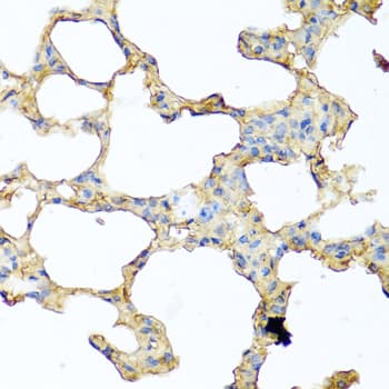 IHC-plus™ Polyclonal Rabbit anti-Human PIP / GCDFP-15 Antibody (IHC, IF)
