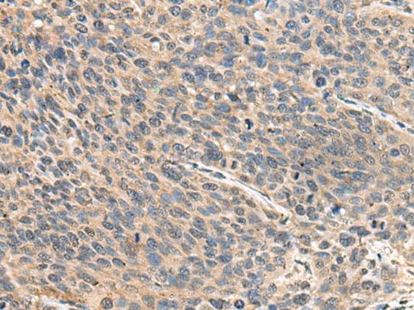Polyclonal Rabbit anti-Human RPS14 / Ribosomal Protein S14 Antibody (IHC, WB)