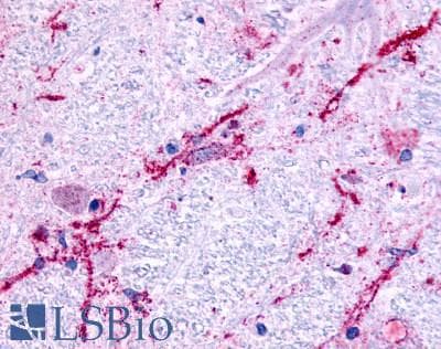 PathPlus™ Polyclonal Rabbit anti-Human ADRA1B / Adrenoceptor alpha 1B Antibody (Cytoplasmic Domain, IHC)