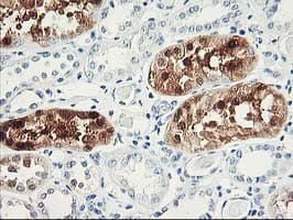 UNG / Uracil DNA Glycosylase Antibody (clone OTI2C12)