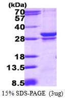 Human RAB23 Protein (Recombinant His)