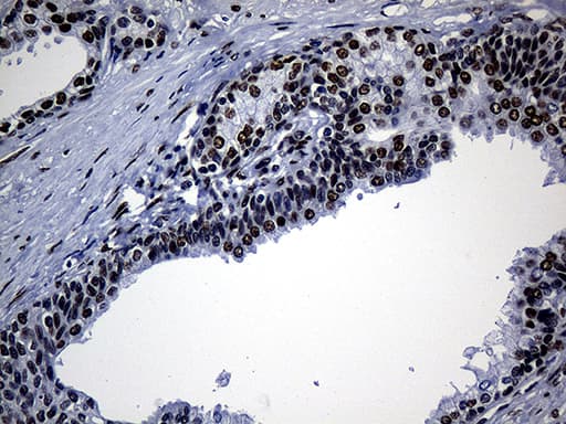 Monoclonal Mouse anti-Human TP53BP1 / 53BP1 Antibody (clone OTI6D9, aa1-300, IHC, WB)
