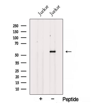 SPTLC1 / HSN1 Antibody