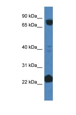 Polyclonal Rabbit anti-Human CUL3 / Cullin 3 Antibody (aa618-667, IHC, WB)