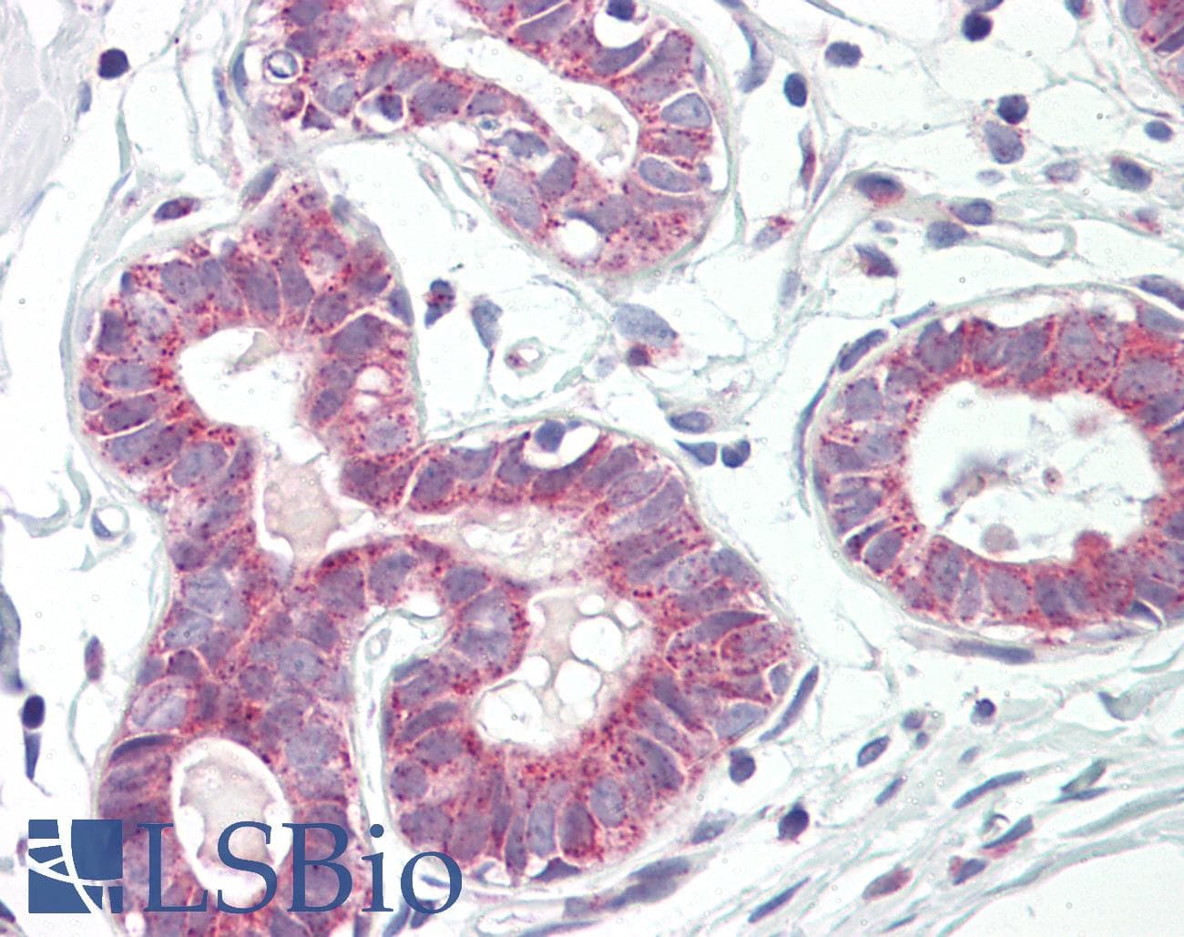 IHC-plus™ Polyclonal Rabbit anti-Human RPL31 / Ribosomal Protein L31 Antibody (aa61-110, IHC)