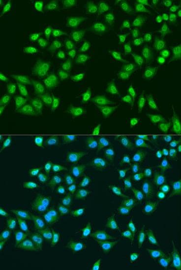 RPS6KB1 / P70S6K / S6K Antibody