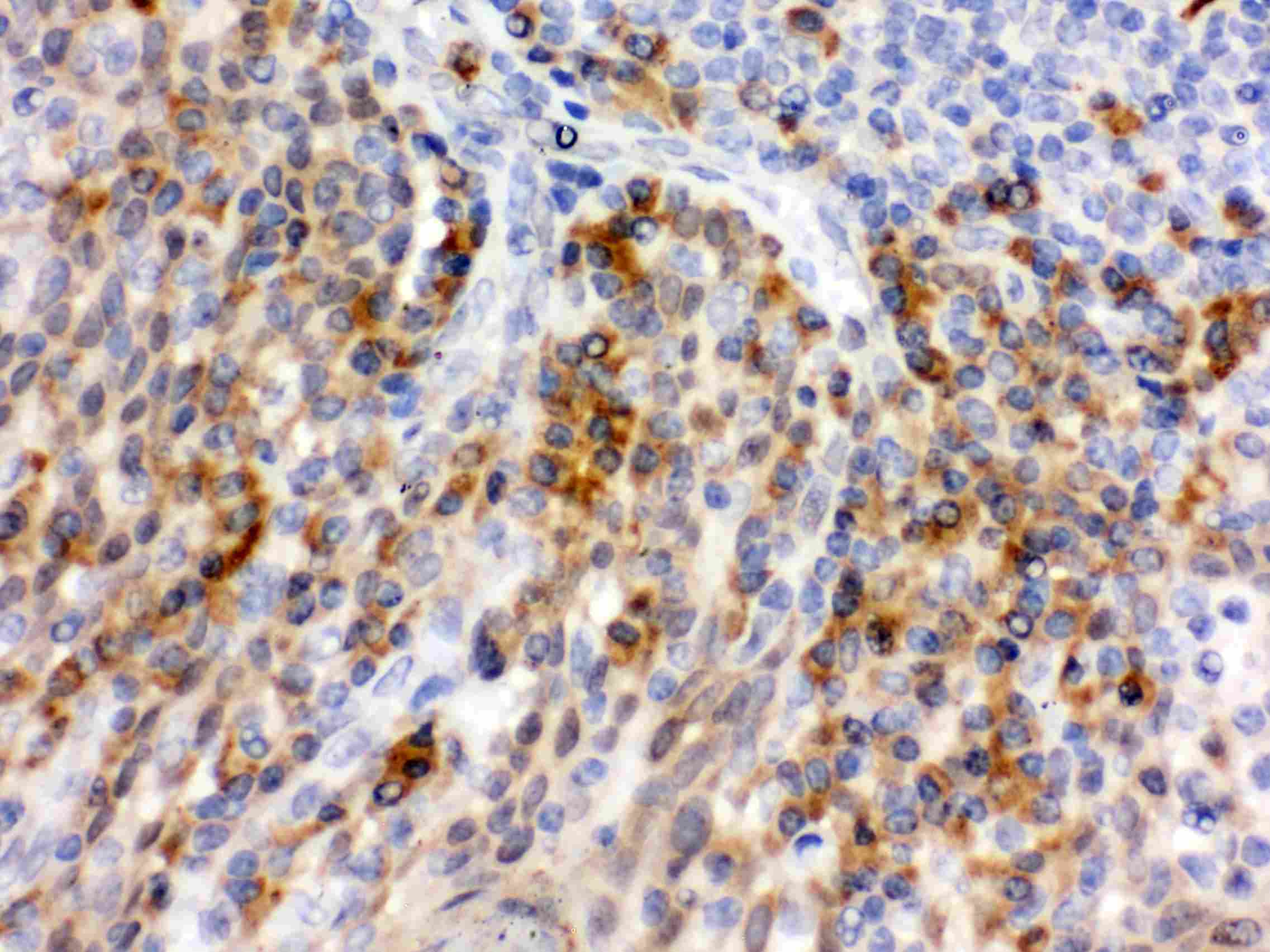 SELP / P-Selectin / CD62P Antibody (aa42-271)