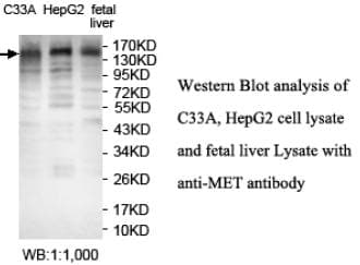 c-Met Antibody (aa586-601)