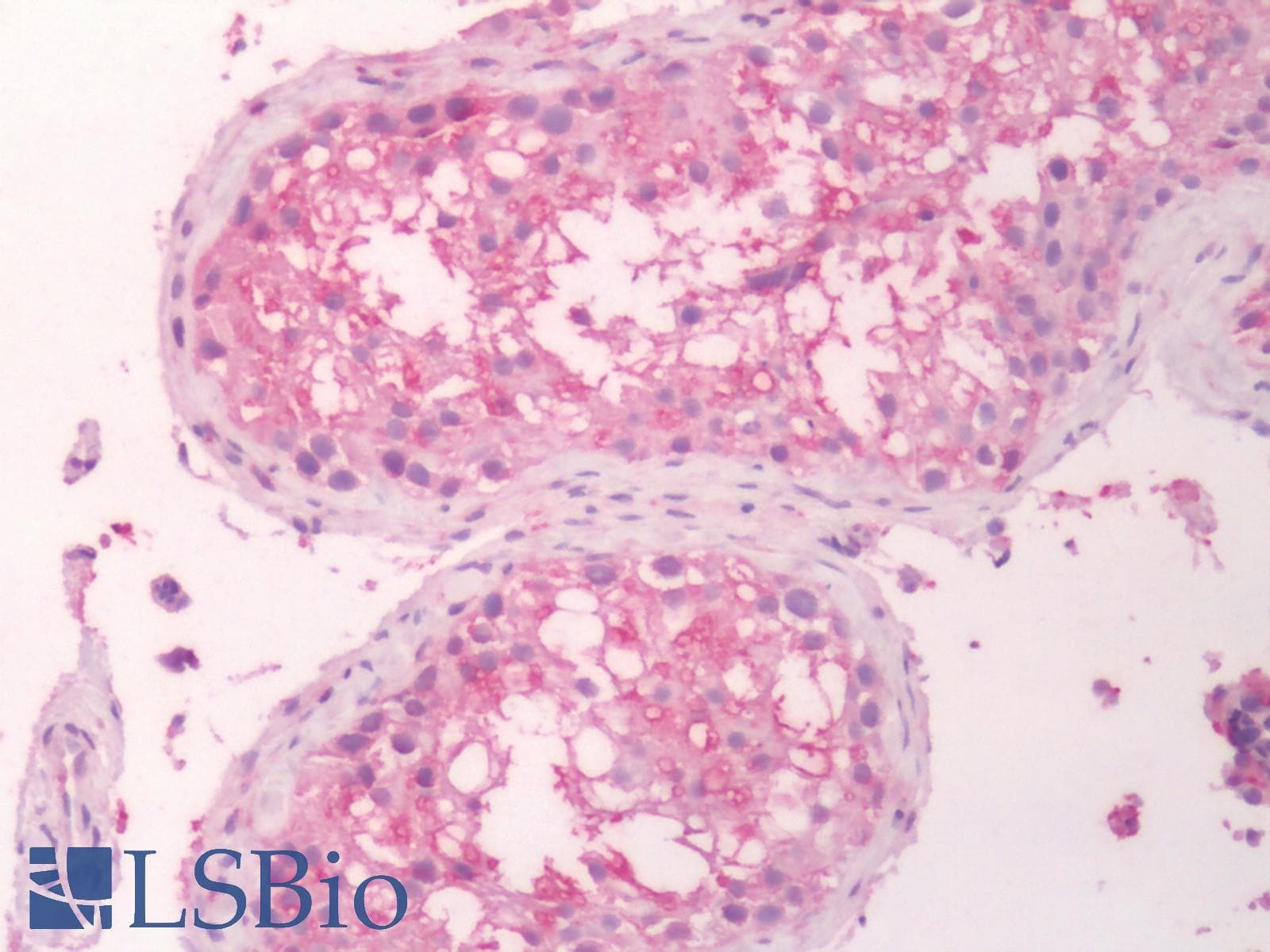 PathPlus™ ADGRD1 / GPR133 Antibody (Cytoplasmic Domain)