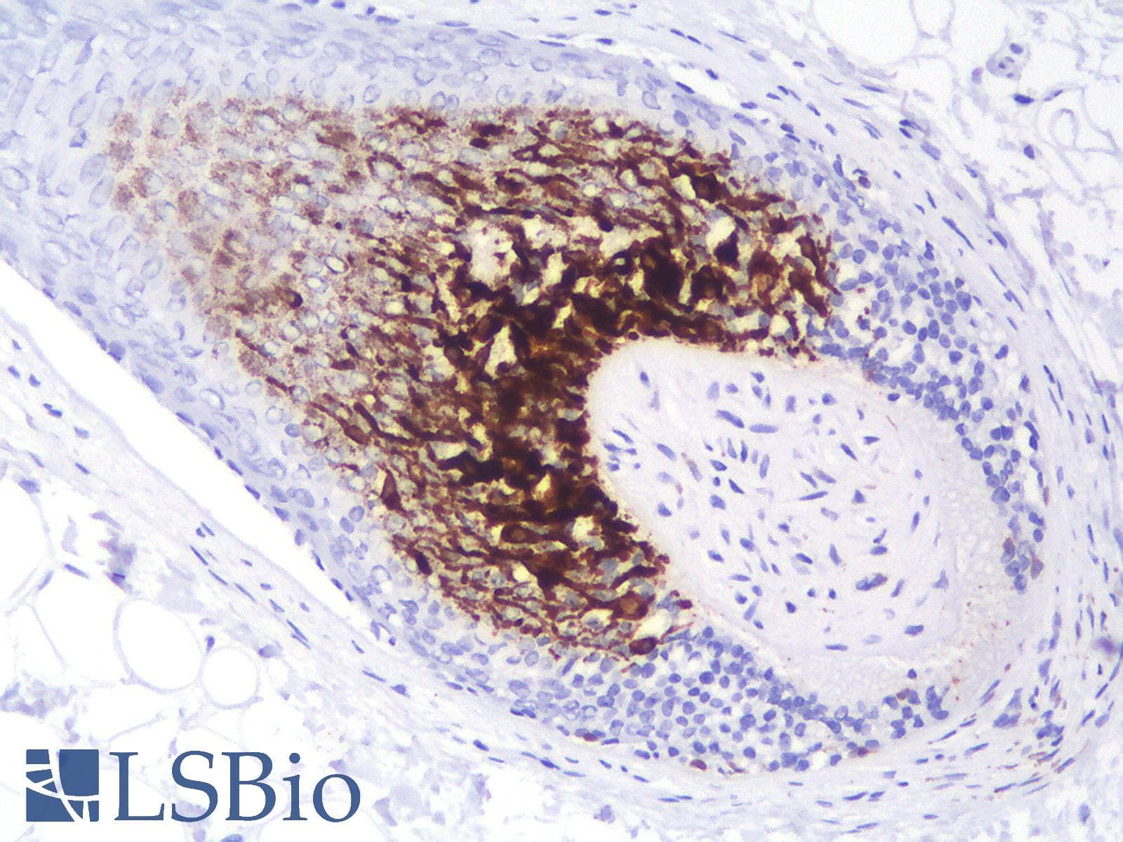 PathPlus™ MLANA / Melan-A Antibody (clone MLANA/1409R)