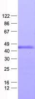 Human ZNF558 Protein (Recombinant His, N-Terminal)