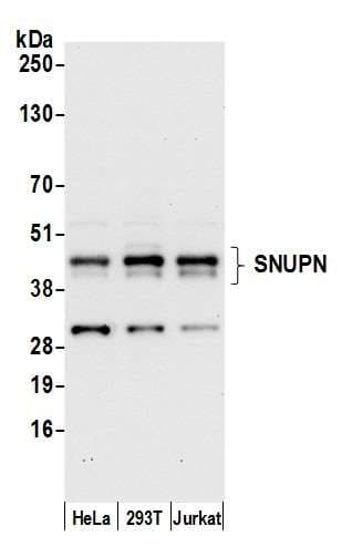 SNUPN Antibody (aa310-360)