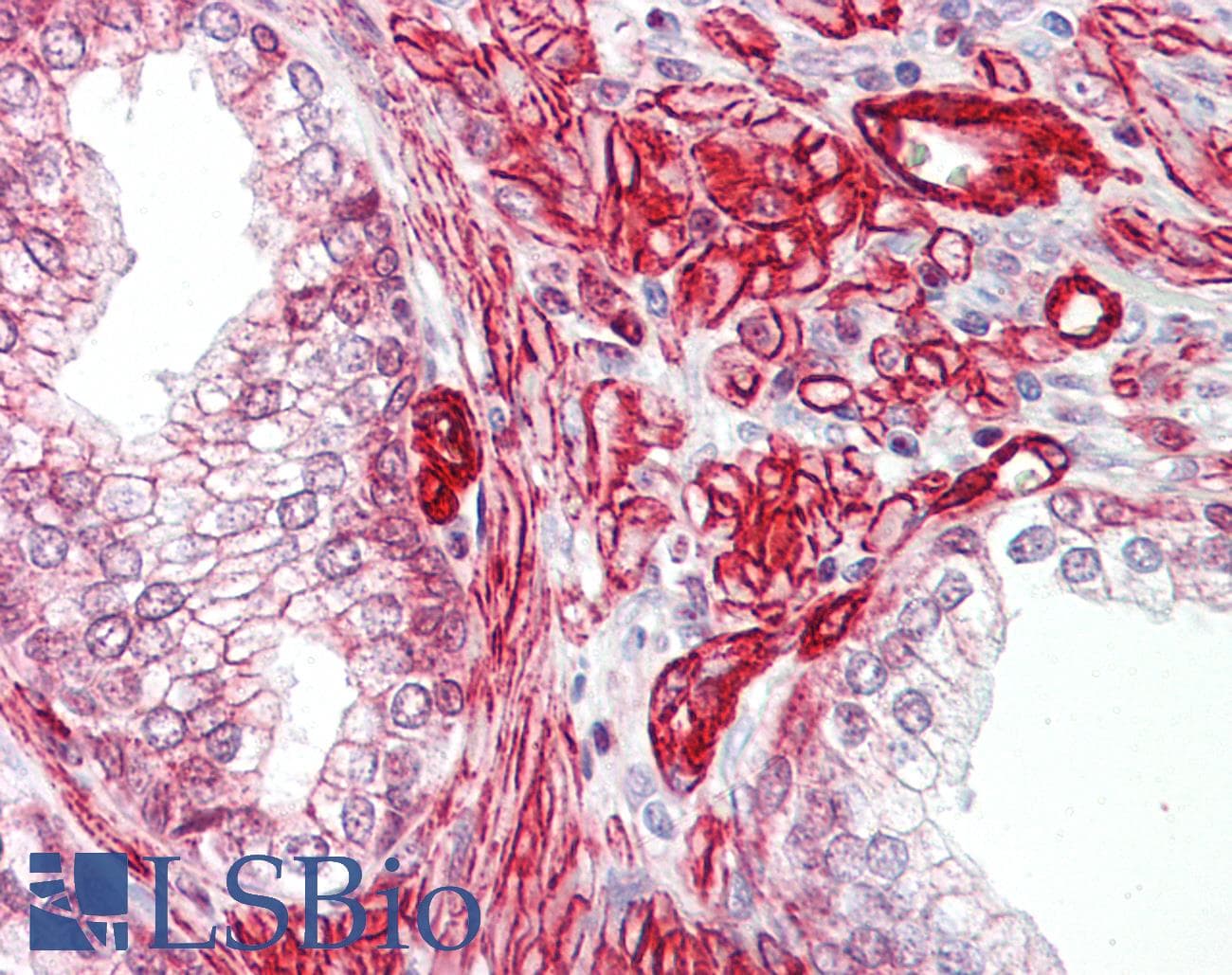 IHC-plus™ Polyclonal Rabbit anti-Human GAB2 Antibody (aa125-174, IHC, WB)