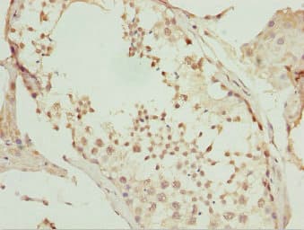 UBE1L2 / UBE1L2 Antibody