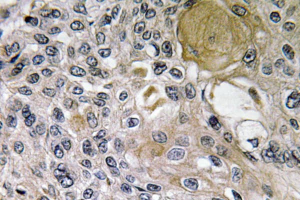 Polyclonal Rabbit anti-Human NTN1 / Netrin 1 Antibody (aa484-533, IHC, WB)
