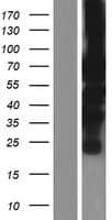 PML Protein (Over-Expression Lysate Myc-DDK (Flag))