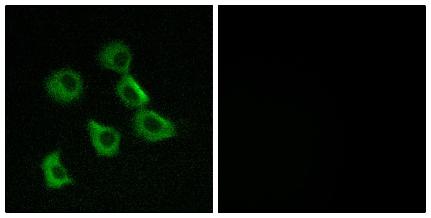 OR52B2 Antibody (aa201-250)
