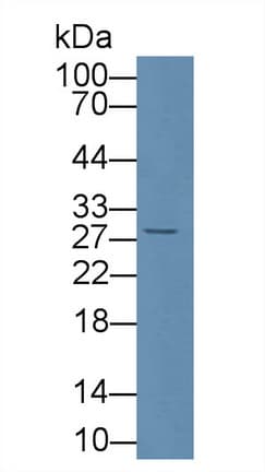 CD8A / CD8 Alpha Antibody (aa26-236)