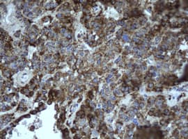 EPHX1 / Epoxide Hydrolase 1 Antibody (aa21-230, clone OTI2D8)