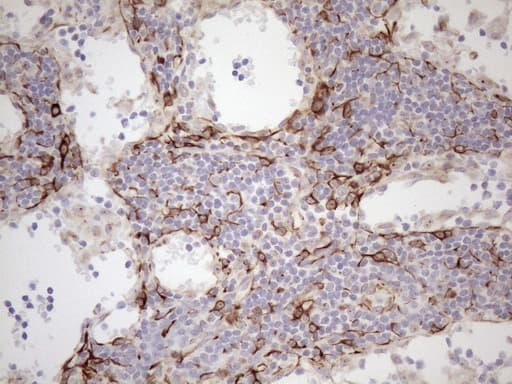 KRT18 / CK18 / Cytokeratin 18 Antibody (aa69-372, clone OTI3D1)