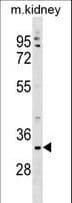 TMEM178 Antibody (aa128-156)