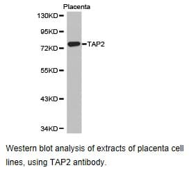 TAP2 Antibody