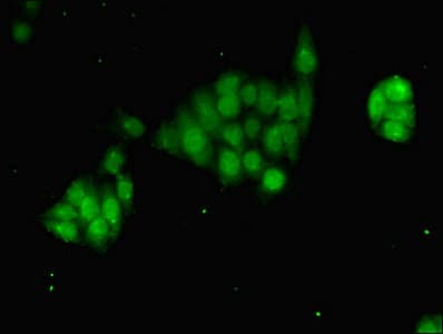 Polyclonal Rabbit anti-Human TFIIB Antibody (WB)