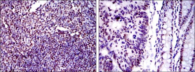 XRCC5 / Ku80 Antibody (clone 5C5)