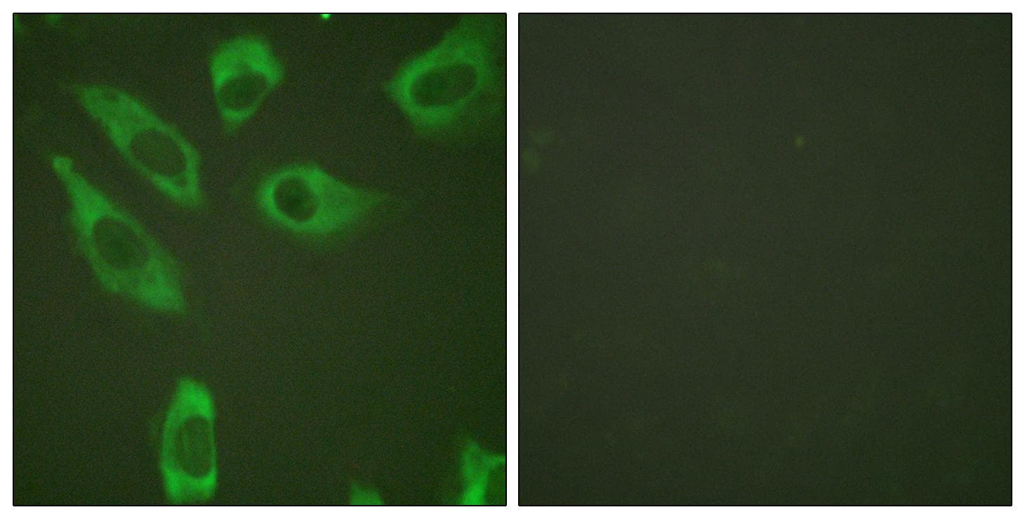 RPS6 / Ribosomal Protein S6 Antibody (phospho-Ser240)