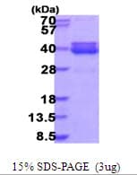 Human NT5C3B / NT5C3L Protein (Recombinant His)