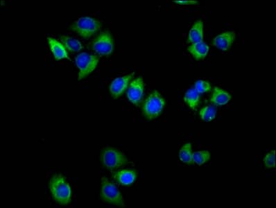 TSPAN18 / TSPAN Antibody