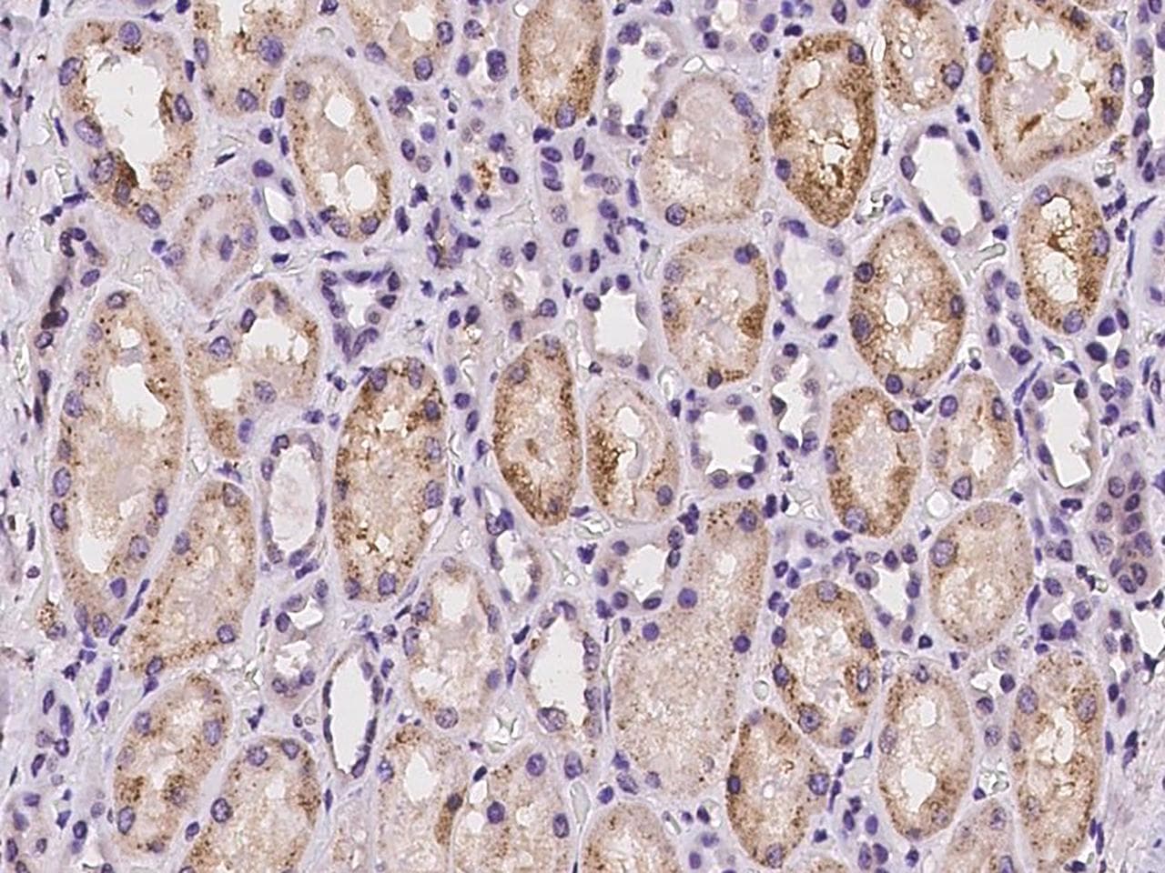 Polyclonal Rabbit anti-Human NAPSA / NAPA / Napsin A Antibody (IHC)