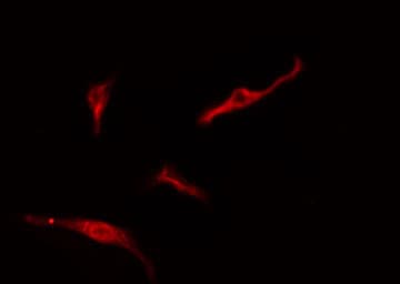 Polyclonal Rabbit anti-Human RPL10A Antibody (IF, WB)