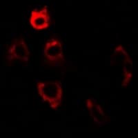 IHC-plus™ Polyclonal Rabbit anti-Human PDIA6 / ERP5 Antibody (IHC, IF, WB)