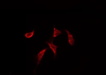 Polyclonal Rabbit anti-Human ATF2 Antibody (IHC, IF, WB)