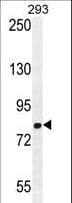 Polyclonal Rabbit anti-Human GGCX Antibody (aa548-578, IHC, WB)