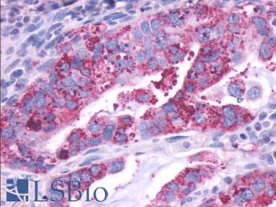 PathPlus™ DRD1 / Dopamine Receptor D1 Antibody (C-Terminus)