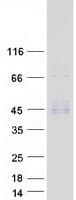 Human ST3GAL6 Protein (Recombinant Myc-DDK (Flag))