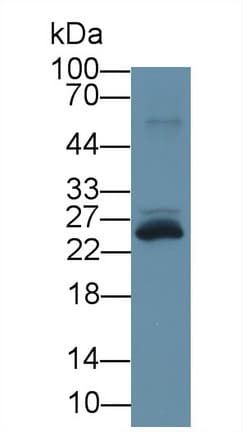 TREM1 Antibody (aa21-205)