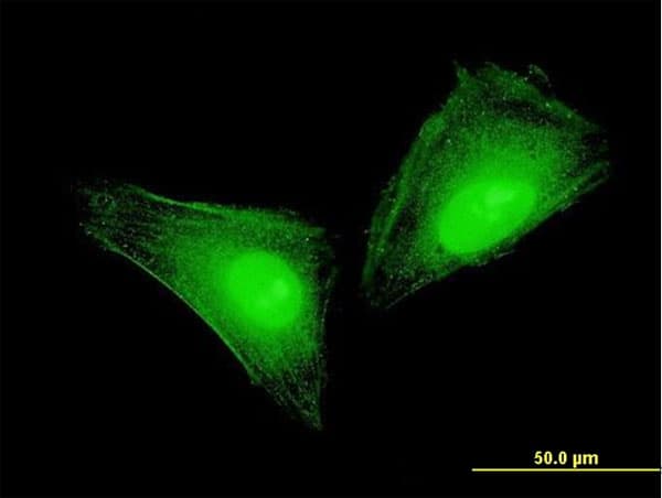 Calgizzarin / S100A11 Antibody (clone 2F4)