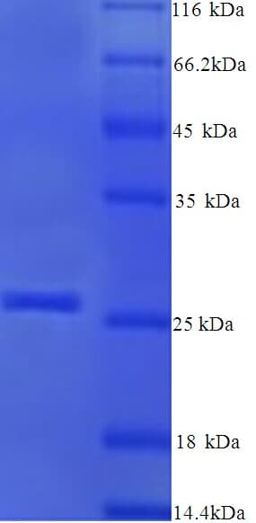 Peanut Ahy03 / Arachin Protein (Recombinant His)