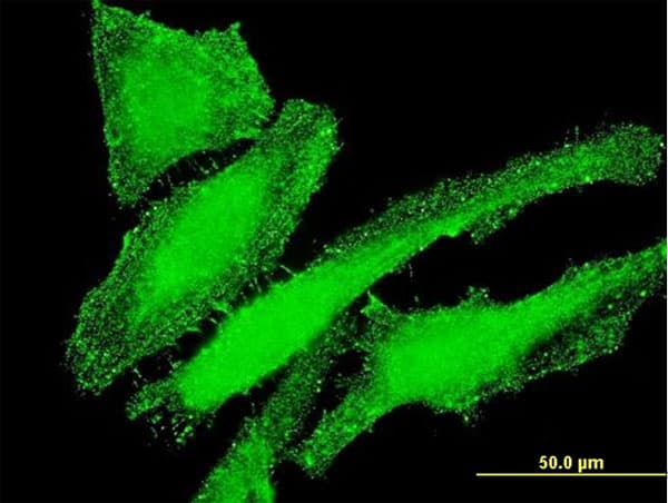 ITGB7 / Integrin Beta 7 Antibody (clone 8D3)