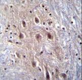 HIPK4 Antibody