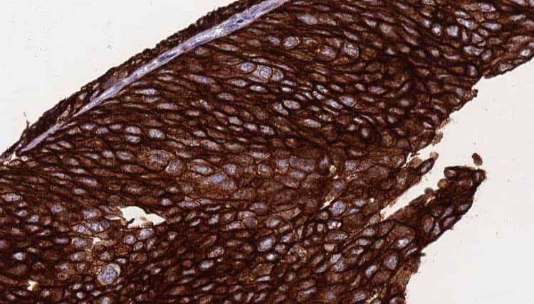 AGER / RAGE Antibody